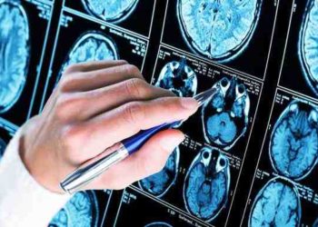 Japoneses investigan fármaco que evita en un 27% el deterioro cognitivo del alzheimer y la demencia